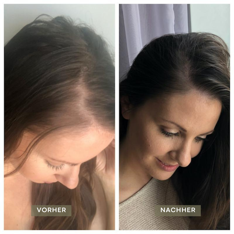 Vorher Nachher